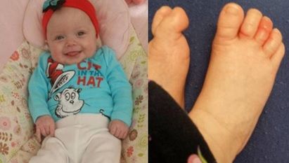 Piciorul bebeluşului era roşu şi umflat. Când s-a uitat la un deget, a îngheţat de spaimă! Acolo...