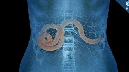 Semne clare că ai paraziți în organism