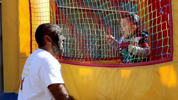 Cum arată cel mai păros om din lume. I se spune "Omul-Lup"