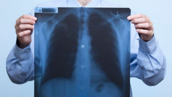 Edemul pulmonar - simptome, diagnostic şi tratament 