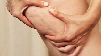 Care sunt alimentele și băuturile care diminuează celulita. Iată ce recomandă specialiștii!