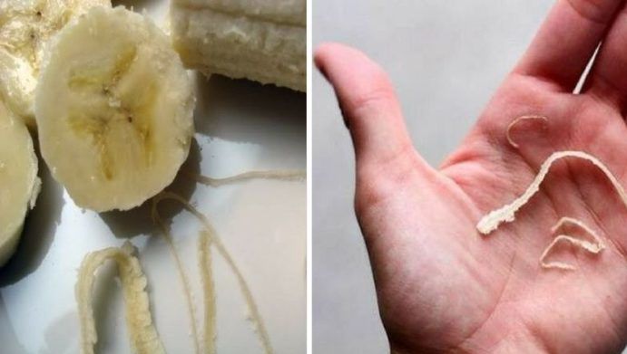 Ai aruncat, până acum, acele "pieliţe" de la banane? N-o mai face! Ascund o mulțime de beneficii