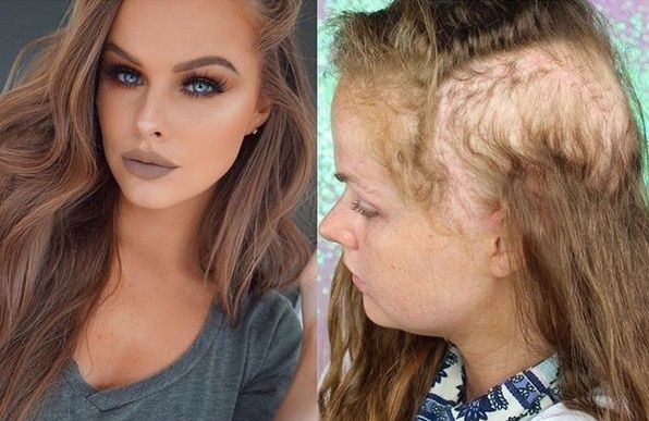 Era frumoasă și invidiată, într-o zi s-a trezit așa. Simptomele unei boli care nu trebuie ignorate