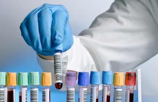 Virusul gripal a mai făcut o victimă. Bilanţul deceselor a urcat la 101