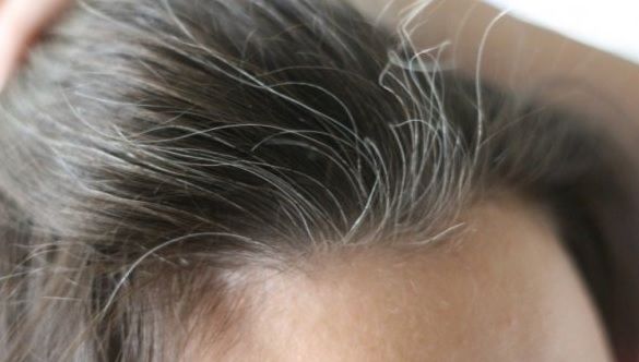 Ce se întâmplă atunci când îţi smulgi firele albe?
