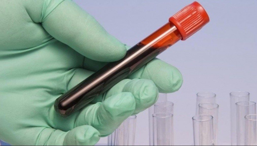 Criza imunoglobulinei, rezolvată prin ordonanţă de urgenţă