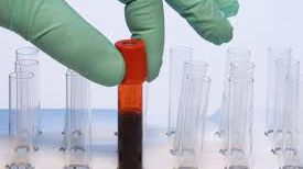 Ministrul Sănătăţii: "Miercuri dimineaţă, cel târziu, încep să ajungă livrările de imunoglobulină"