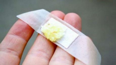 A pus usturoi pe un plasture și l-a lipit pe piele. După 2 săptămâni, ceva uimitor s-a întâmplat