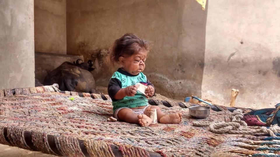 Bărbatul care trăiește în corp de bebeluș. Imagini dure 