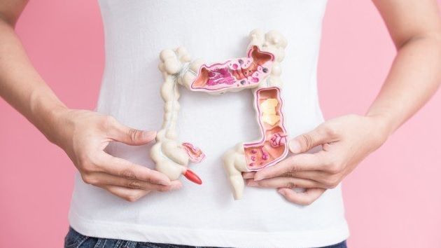 Avertismentul teribil al medicilor: aceasta este schimbarea fizică ce anunţă cancerul la colon