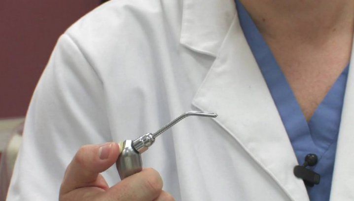 De frica dentistului, şi-a lipit singură dinţii cu super glue. Cum arată dantura femeii acum. Şoc!