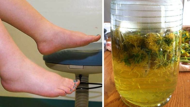 Zece moduri naturale prin care să reduci retenția de apă din organism