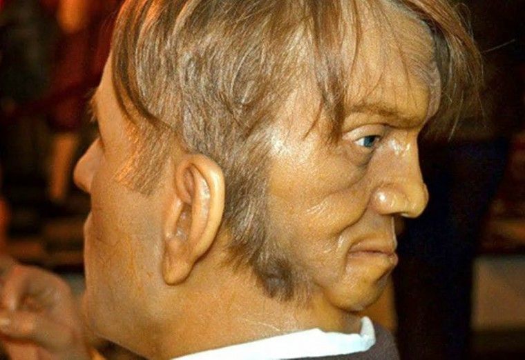 Povestea de speriat a omului care s-a născut cu două feţe. E o ciudăţenie a naturii