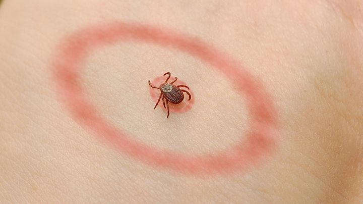 Boala Lyme. Descoperire fabuloasă a oamenilor de ştiinţă