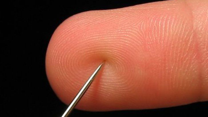 Accident vascular cerebral - metoda care îţi poate salva viaţa