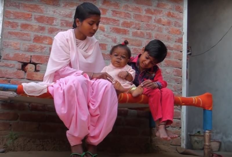 Povestea terifiantă a bărbatului care, la 23 de ani, arată ca un bebeluş. Suferă de o boală rară