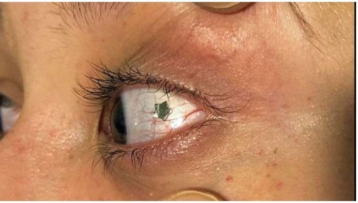 Bijuteriile din ochii tinerilor. Moda care pune viaţa în pericol