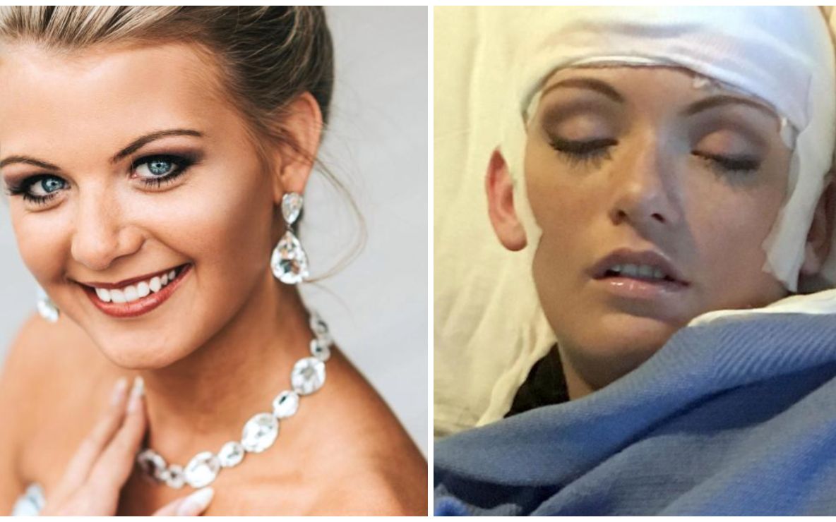 Ea este Frumoasa Adormită, tânăra care doarme 20 de ore pe zi. Povestea ei, tragică