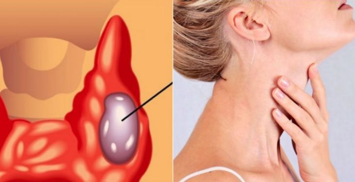 Cea mai bună gustare pentru tiroidă: un endocrinolog îţi spune ce să mănânci zilnic