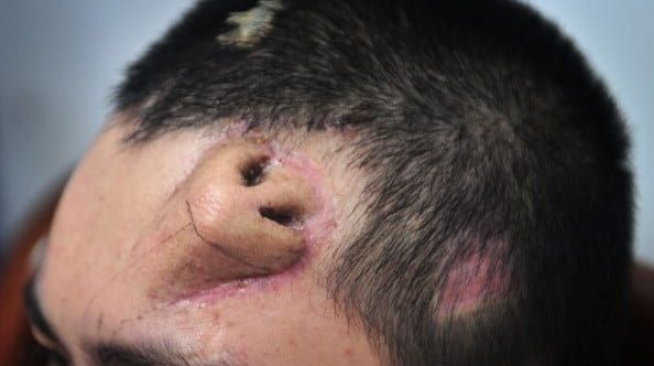 I-a crescut un nas pe frunte