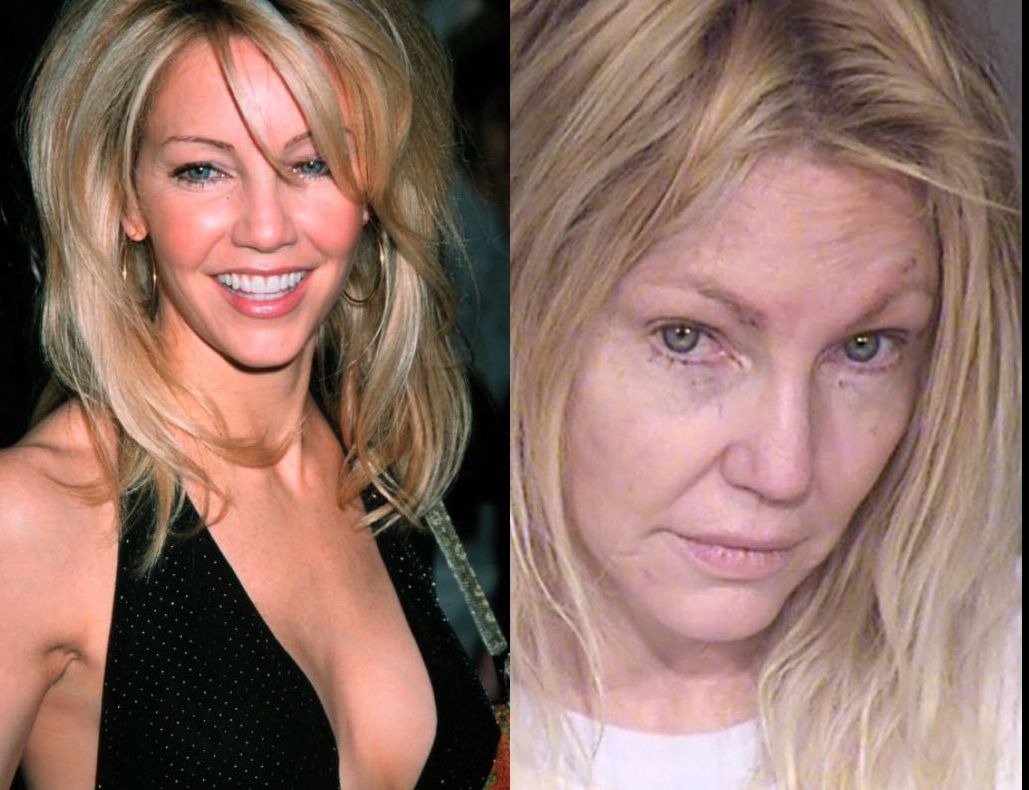 O celebră actriţă a încercat să se sinucidă - a ajuns la psihiatrie. Nu îţi vine să crezi cum arată 