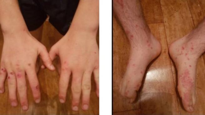 Medicii sunt şocaţi: Tânăr infectat cu virus dispărut în urmă cu 300 de ani