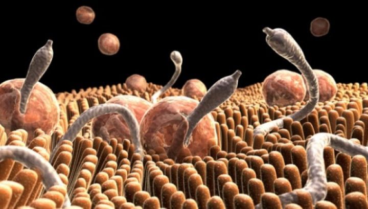 Mare atenție! Acestea sunt simptomele infecţiei cu paraziţi intestinali