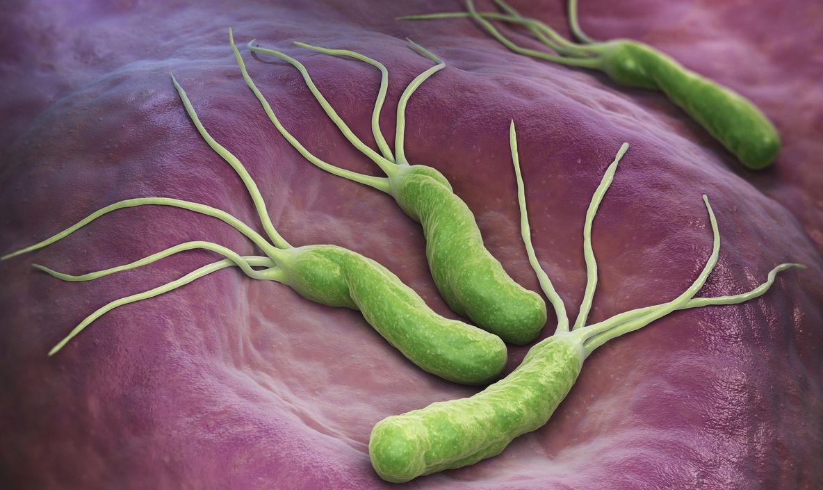 Această bacterie cauzează cancer de stomac. Cum te poţi feri de ea