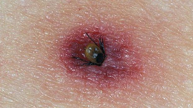 Alertă în parcurile din Bucureşti, s-a declanşat mai devreme Operaţiunea "Căpuşa"