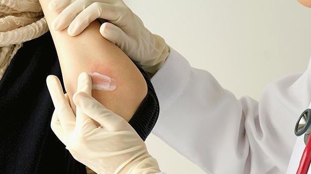 Persoanele cu această grupă de sânge atrag căpușele