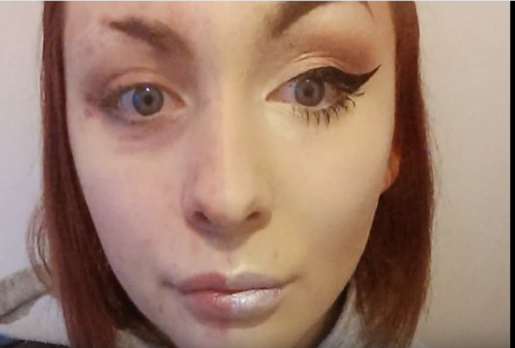 Adolescenta şi-a dat jos machiajul pentru prima dată. Când a văzut-o, iubitul a părăsit-o