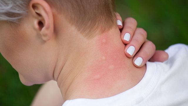 PMB: Începe aplicarea celui de-al 10 lea tratament de combatere a ţânţarilor