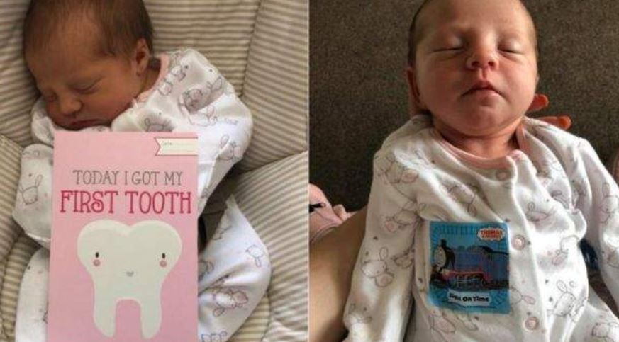 Povestea uluitoare a fetiţei care s-a născut cu un dinte. Ce a păţit după 12 zile