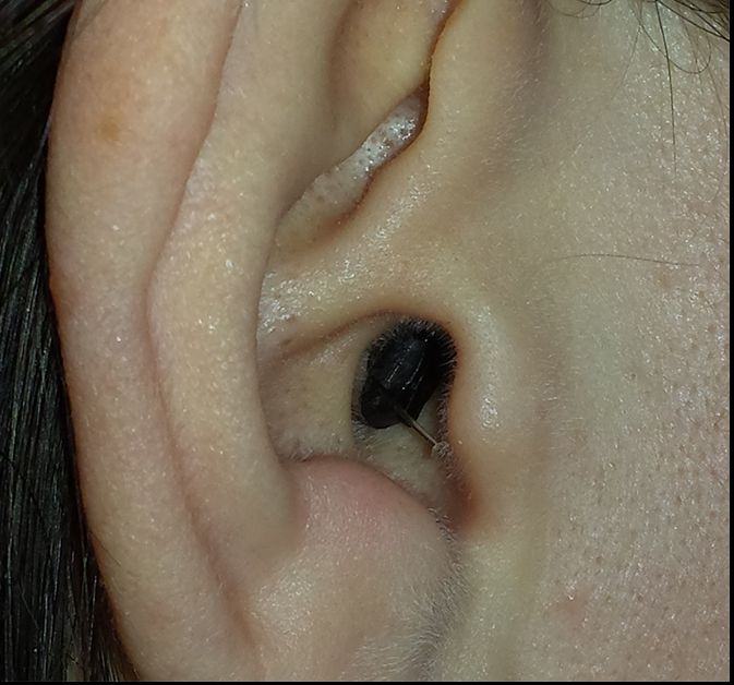 Dispozitivul de copiat l-a trimis direct în cabinetul ORL