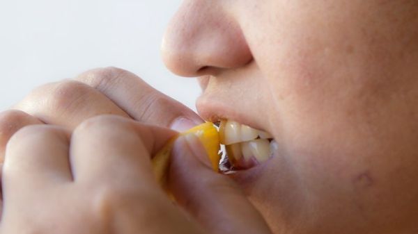 Nu mai arunca cojile de banane. Cum să-ți albești dinții rapid 