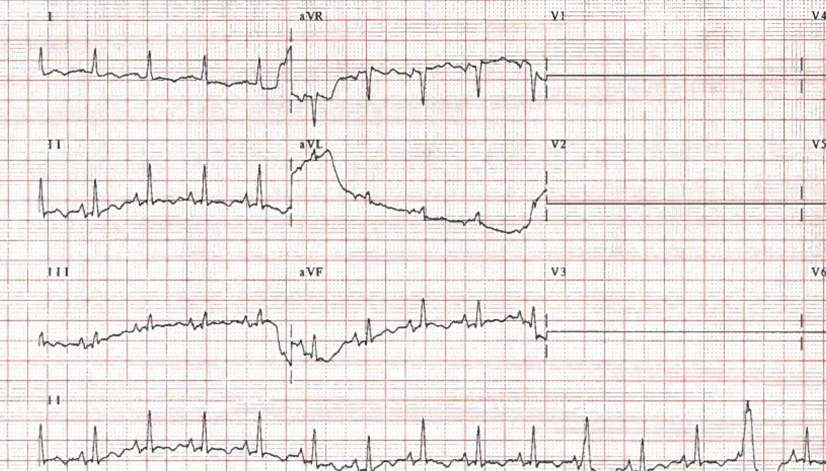 Obiceiul mai nociv decât fumatul! Şi tu îl ai în fiecare zi. Ai mare grijă 