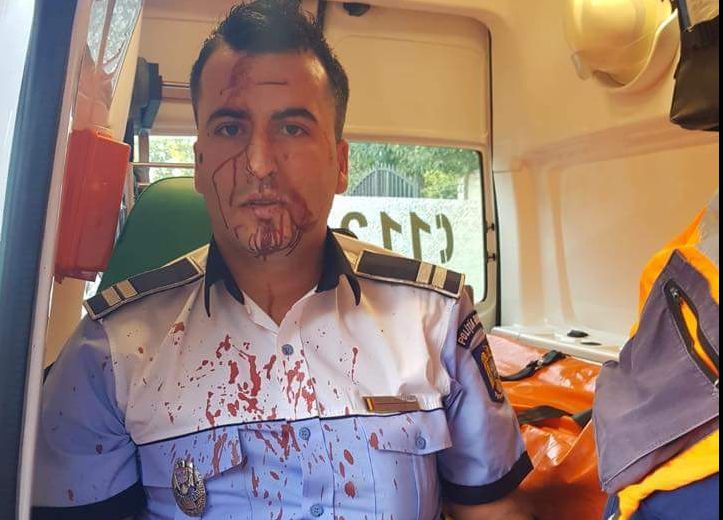 Poliţist de la Rutieră, bătut crunt de un șofer în trafic. Bărbatul a fost reţinut 