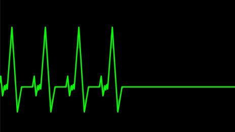 Cum ştii că moartea este aproape. Ce spun medicii despre cei cărora li se apropie sfârşitul