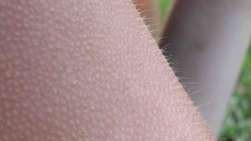 E uimitor ce se spune despre persoanele care resimt foarte des "pielea de găină"