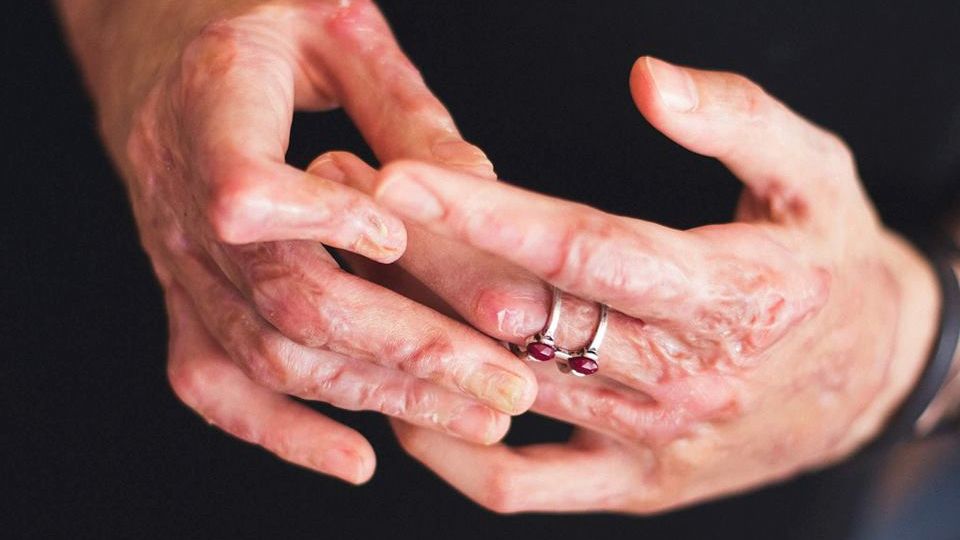 Alexandra Furnea, supravieţuitoare #colectiv: "Pentru noi, Colectiv se repetă în fiecare zi"