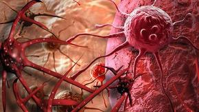 Descoperire: Motivul evident care îţi spune dacă vei face cancer 