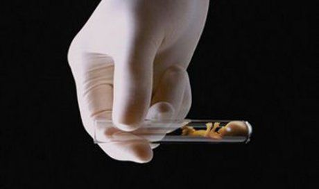 Primul copil conceput în eprubetă a împlinit 40 de ani! Cum arată acum? VIDEO