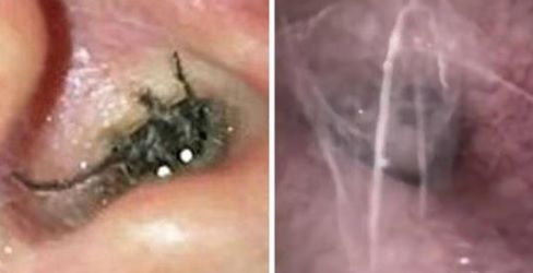 Auzea întruna un ţiuit în ureche. A mers la ORL-ist, iar ce a scos de acolo este şocant!