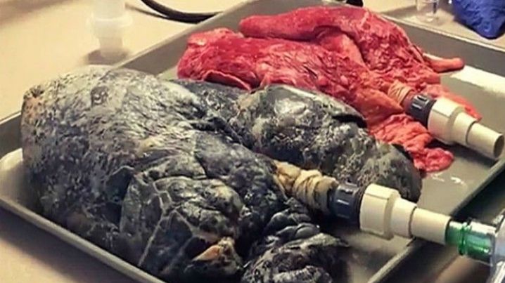 Cum arată plămânii unui fumător?