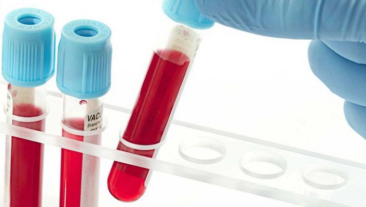 Cel mai mare studiu clinic al unui test de sânge care poate detectat 50 de tipuri de cancer, demarat în Marea Britanie