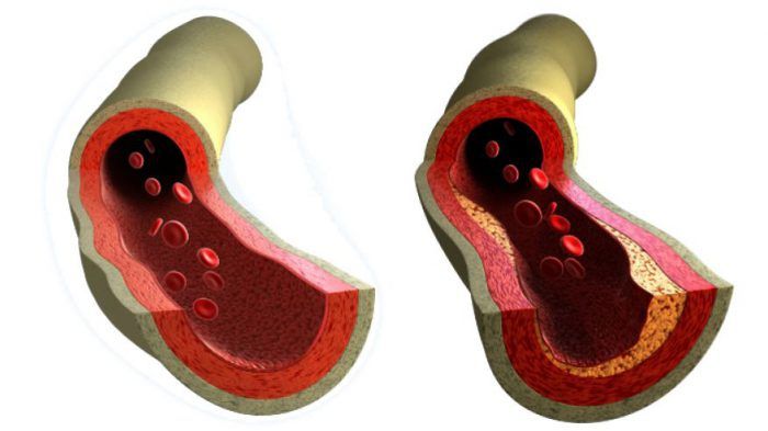 Vitamina care poate preveni bolile cardiovasculare