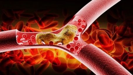 Colesterolul este văzut ca ceva rău, însă acesta deține un rol crucial în organism