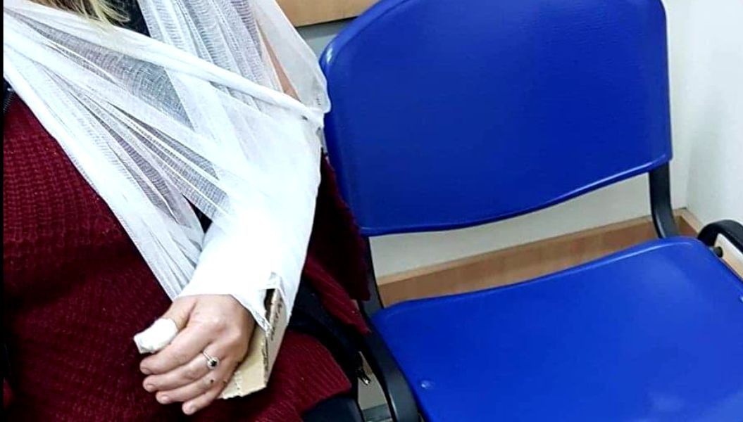 E ireal! Medicii i-au fixat unei femei mâna ruptă cu o bucată de carton! FOTO