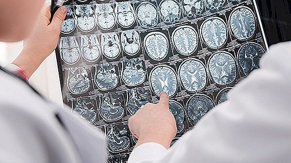 Boala Niemann-Pick, cea mai dificilă boală genetică de metabolism