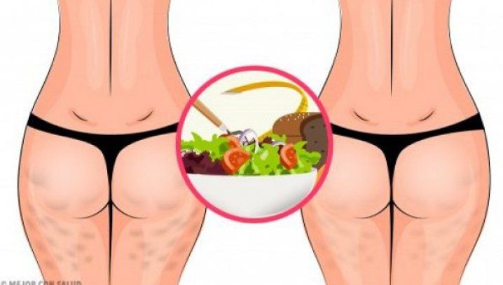 Cum poți scăpa rapid de celulită 